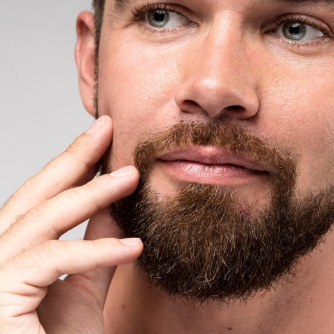 beard-transplant