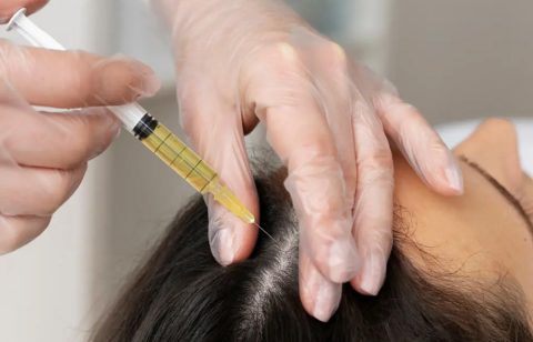 mesotherapy